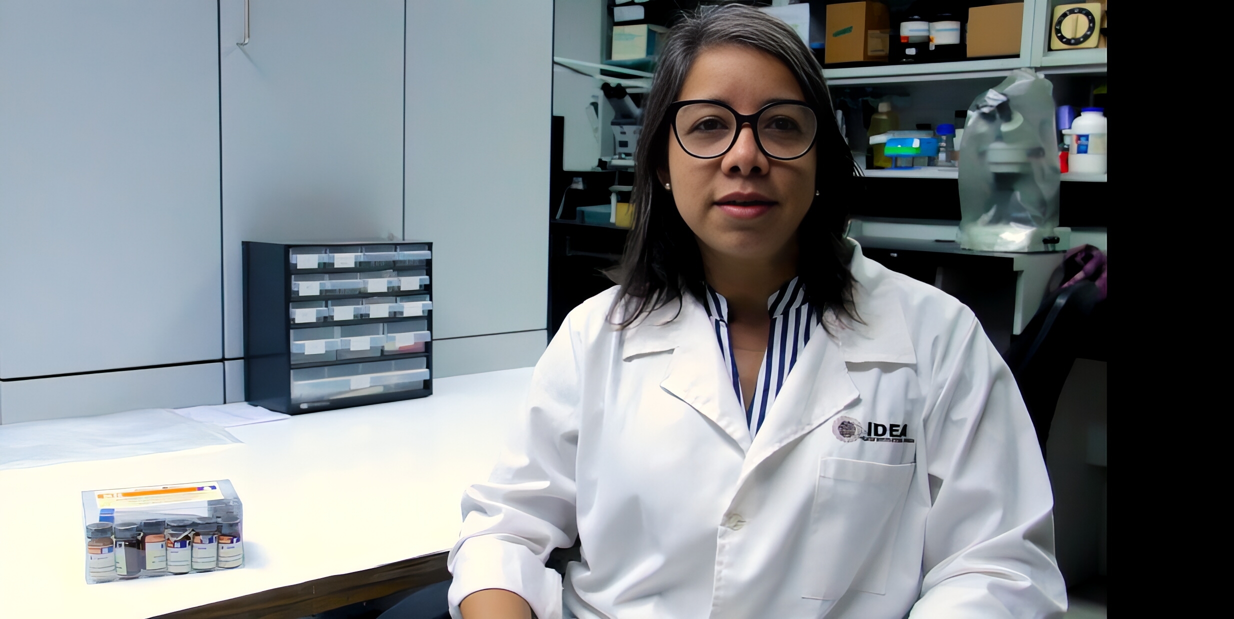 Primer estuche venezolano determinará la composición química de los cálculos renales por vía húmeda